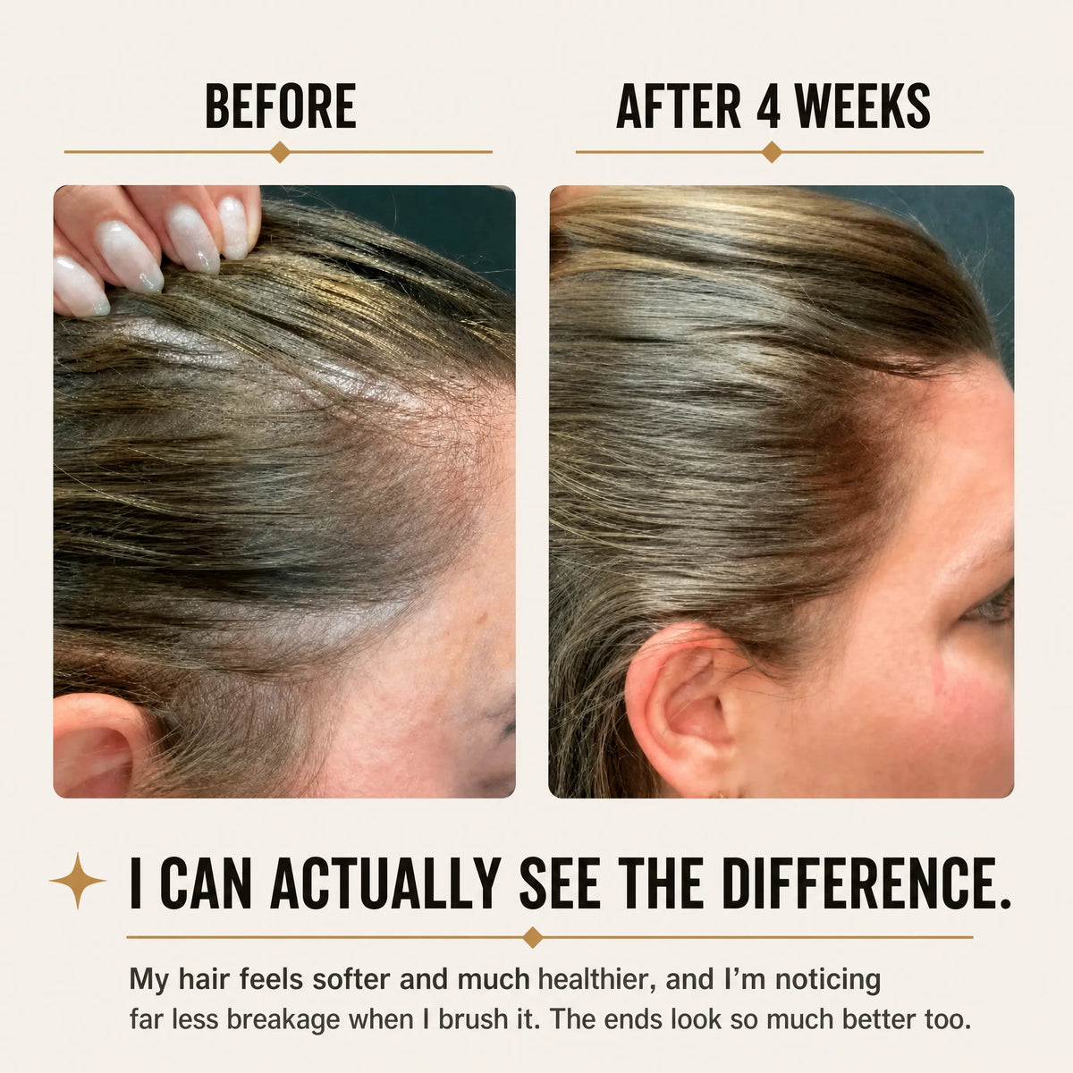 Anelvia Strand Repair Capsules